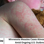Minnesota Measles Cases Almost Double Amid Ongoing U.S. Outbreaks