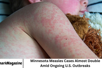 Minnesota Measles Cases Almost Double Amid Ongoing U.S. Outbreaks