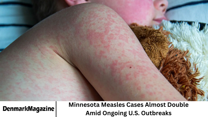 Minnesota Measles Cases Almost Double Amid Ongoing U.S. Outbreaks